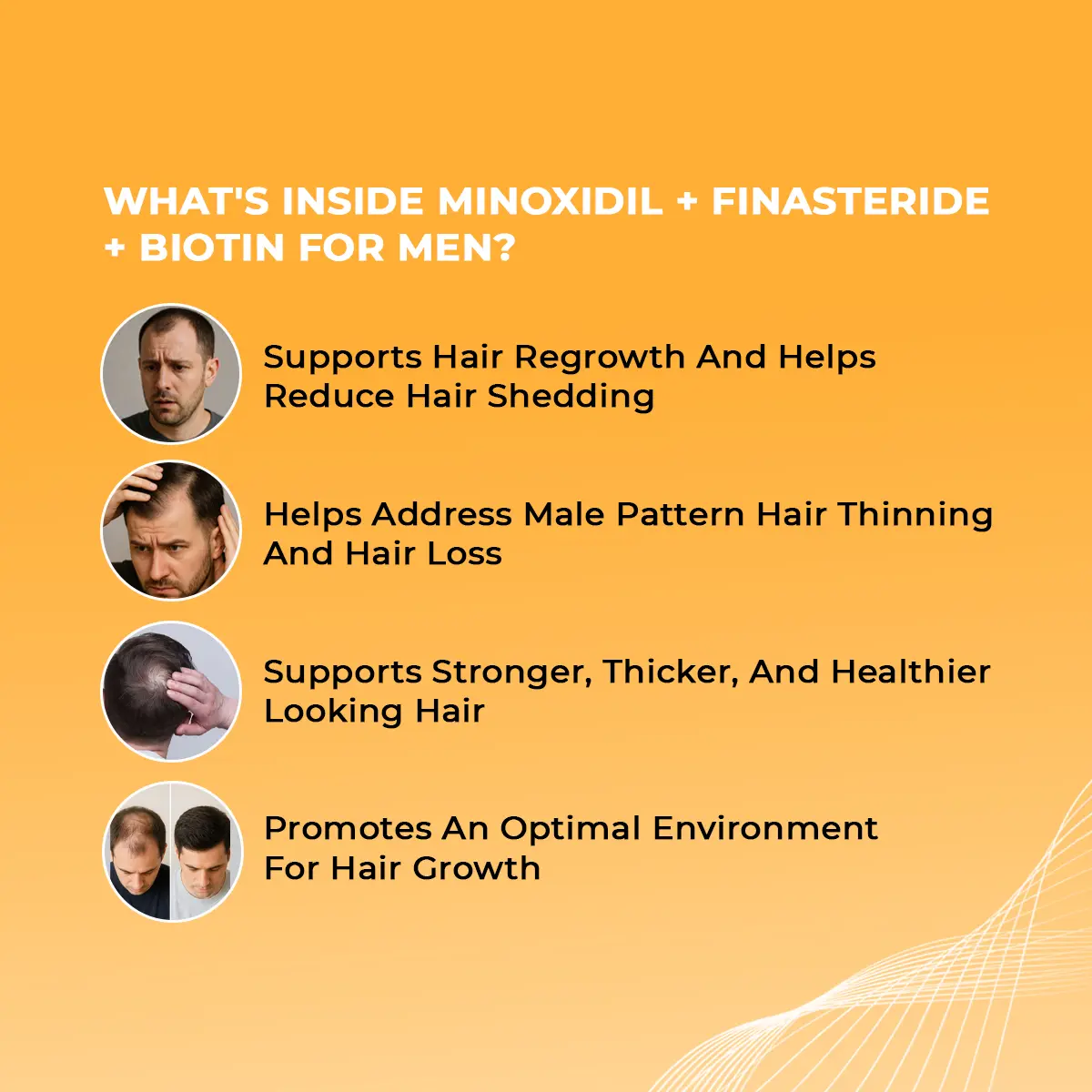 Men's Hair Loss(Minoxidil, Finasteride, Biotin)